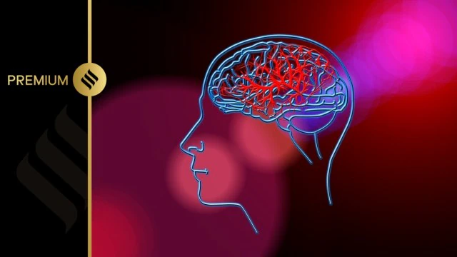 Hope for brain stroke patients: How a stent can clear blood clots in 24 hours